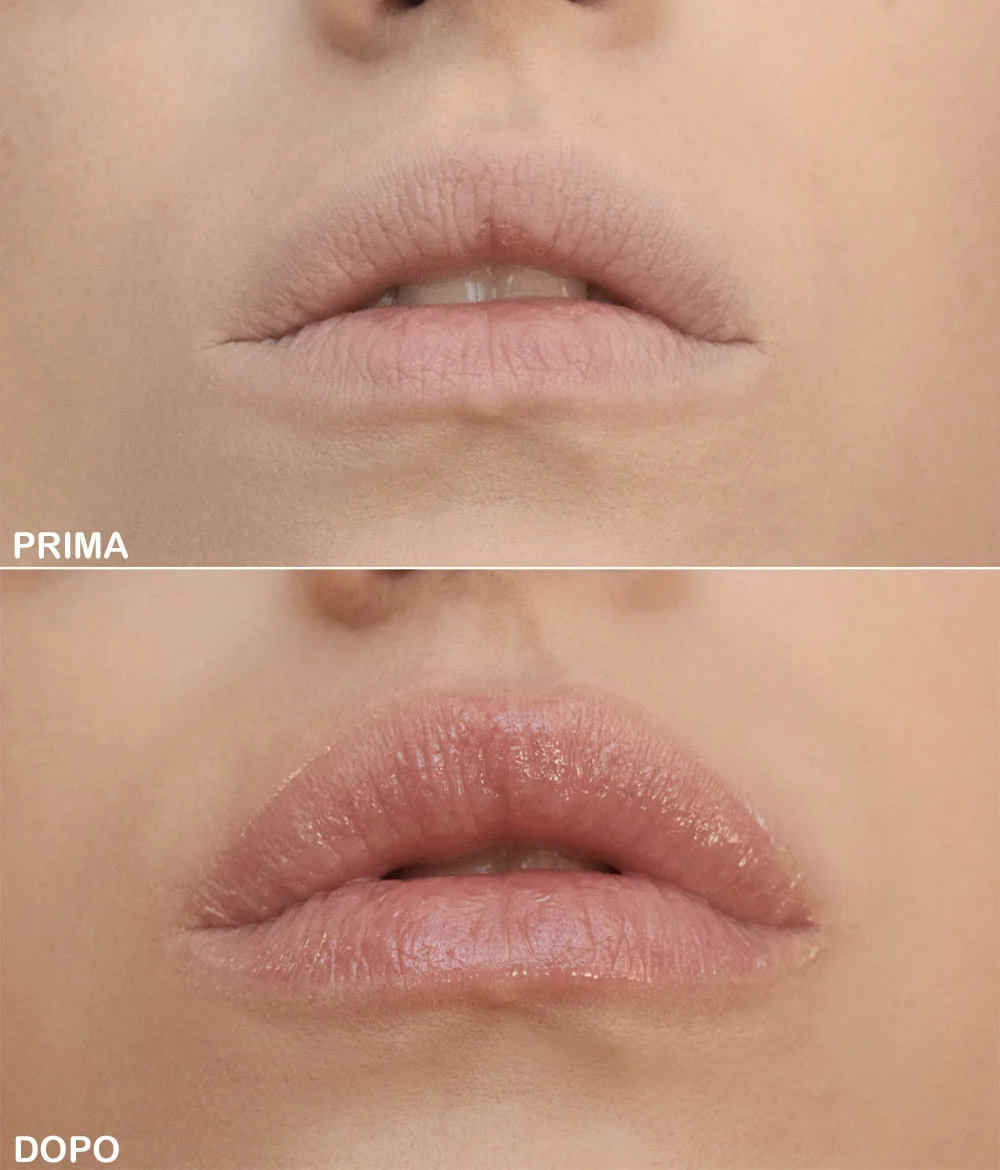 Come avere labbra carnose senza trucco Come avere labbra carnose senza trucco