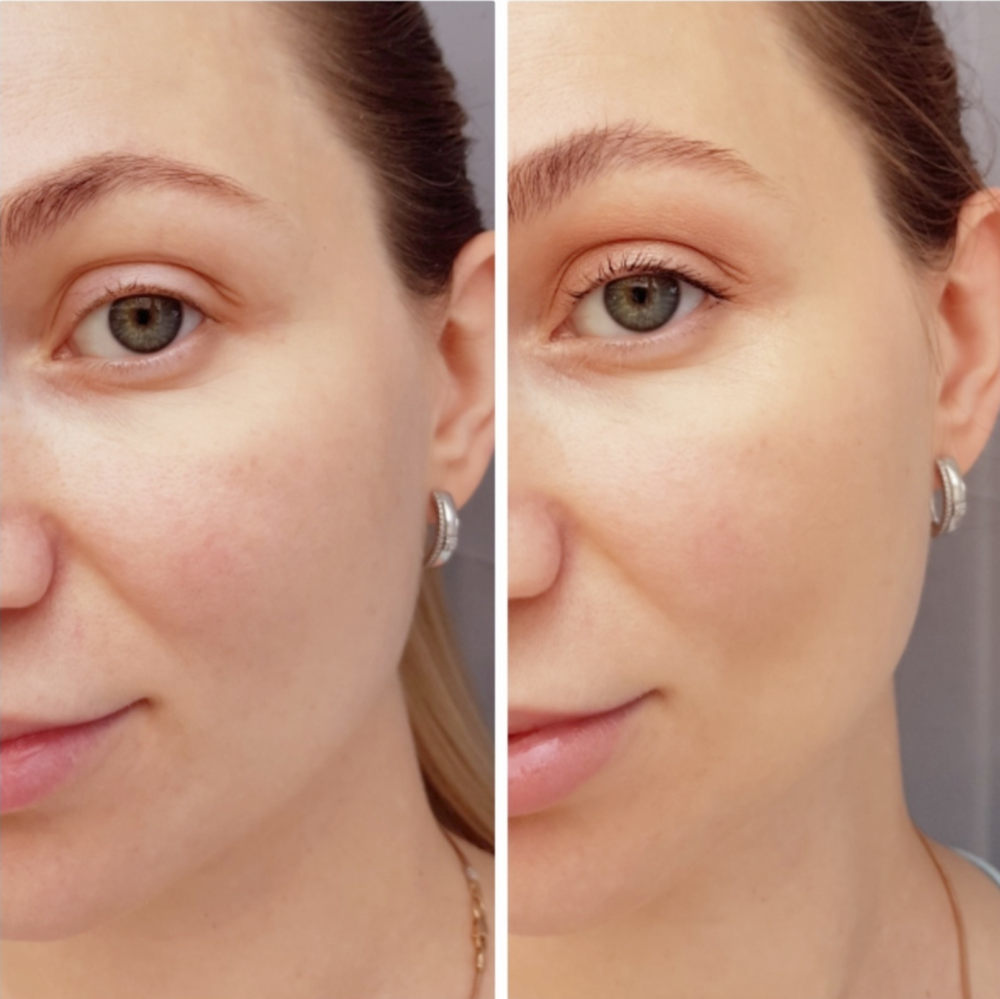 Prima e dopo BB cream Shiseido Prima e dopo BB cream Shiseido