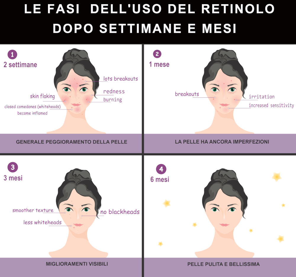 Uso del retinolo per pulire e purificare la pelle